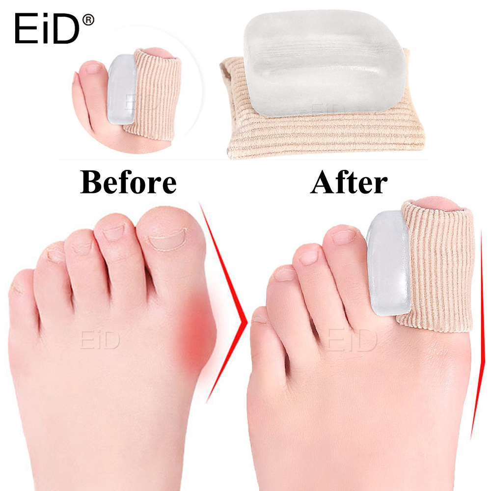 Toe Separator Silicon - 2 PCS Silicone Gel Thumb Corrector