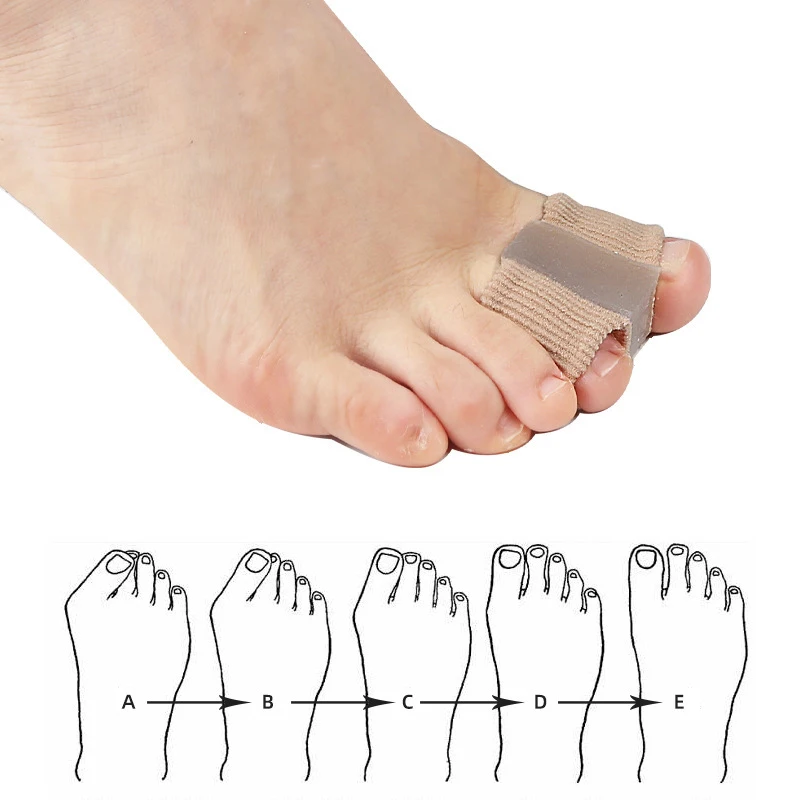 New Toe Separator Hallux Valgu - Toe Separator Silicon 评论和价格