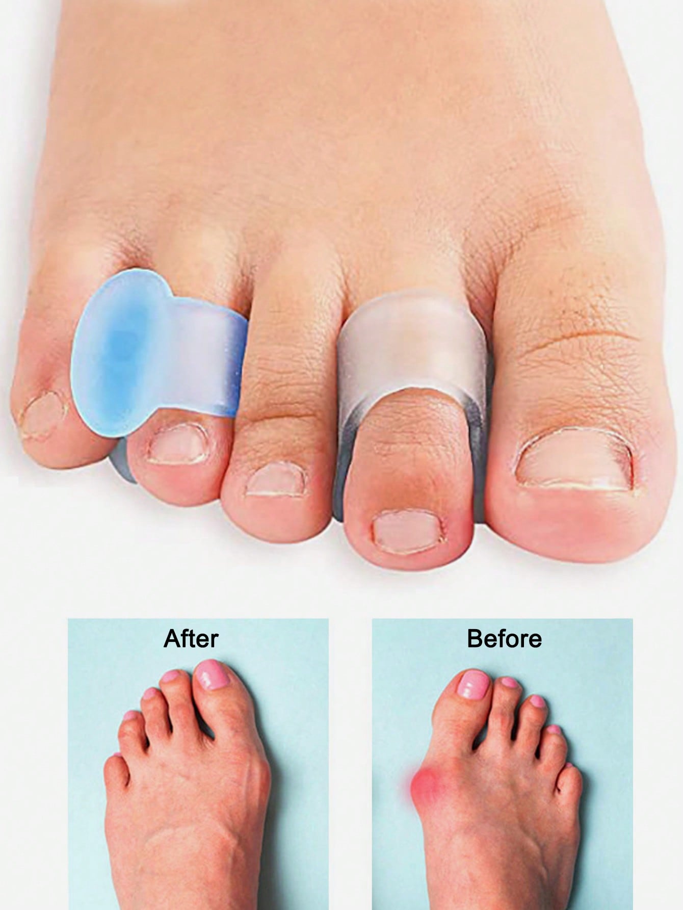 Gel Toe Separator, 4pcs Silico - Toe Separator Silicon 评论和价格